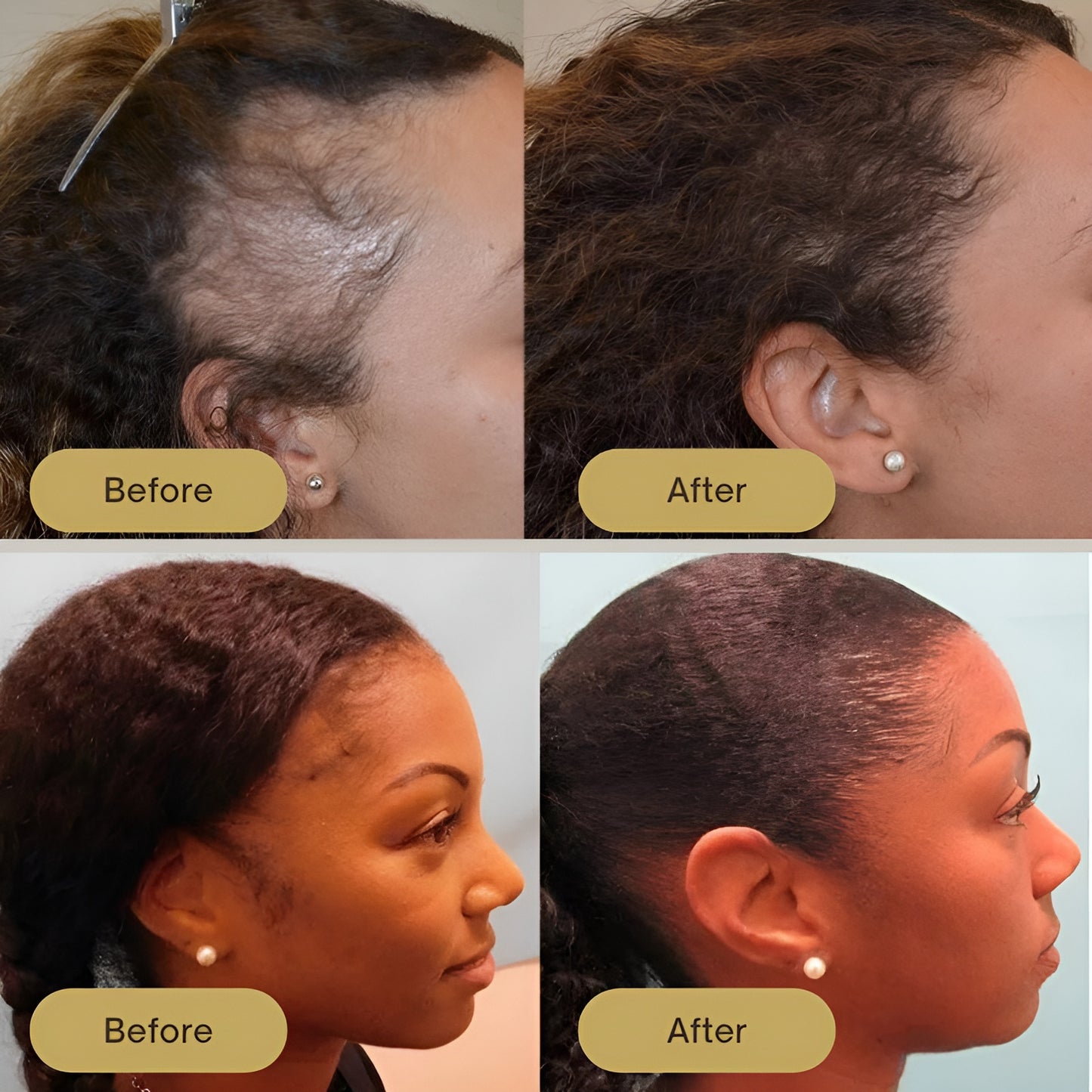 PureGrow Hair Oil