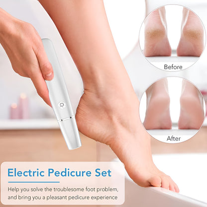 SmoothStride Callus Remover