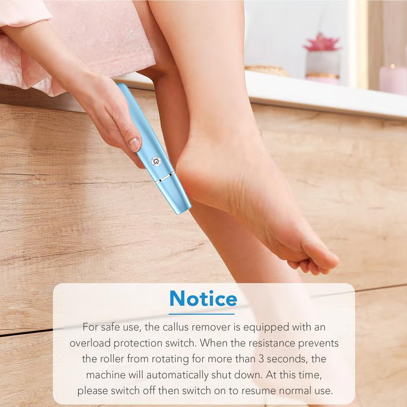 SmoothStride Callus Remover
