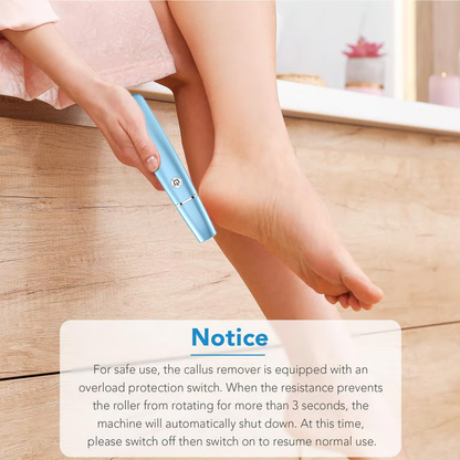 SmoothStride Callus Remover