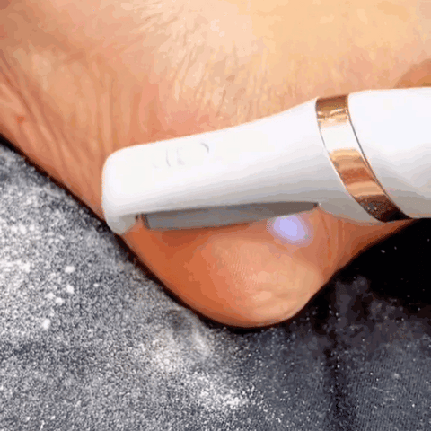 SmoothStride Callus Remover