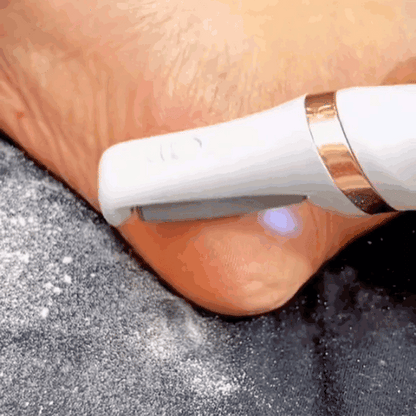 SmoothStride Callus Remover