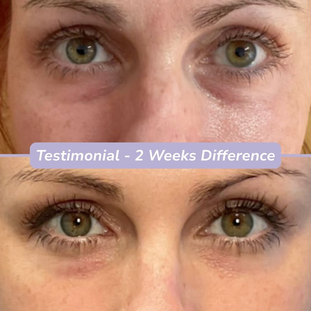 FlashFix | Deepcare Patches